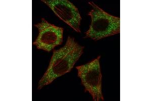 Immunofluorescence (IF) image for anti-Small Nuclear Ribonucleoprotein Polypeptide E (SNRPE) antibody (ABIN3003507) (SNRPE antibody)