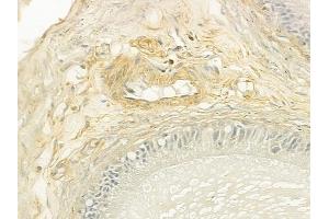 ABIN6260013 and ABIN6279138 at 1/100 staining human testicular cancer by IHC-P. (Aquaporin 8 antibody  (N-Term))