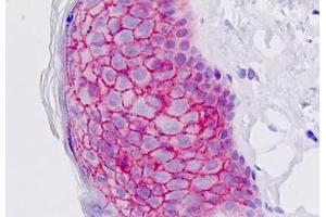 Human Skin, Epidermis: Formalin-Fixed, Paraffin-Embedded (FFPE) (EMP2 antibody  (AA 100-129))