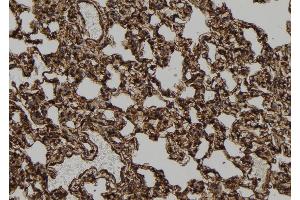 ABIN6278832 at 1/100 staining Rat lung tissue by IHC-P. (2-Apr antibody)