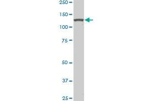 HIPK2 monoclonal antibody (M03), clone 1F10. (HIPK2 antibody  (AA 961-1065))