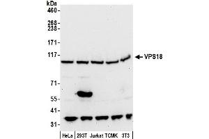 anti-Vacuolar Protein Sorting 18 Homolog (VPS18) (AA 1-50) antibody