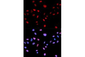 Immunofluorescence analysis of MCF-7 cells using Phospho-CDK1-T161 antibody (ABIN5969957). (CDK1 antibody  (pThr161))
