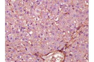 Paraformaldehyde-fixed, paraffin embedded rat liver section, Antigen retrieval by boiling in sodium citrate buffer (pH6) for 15min, Block endogenous peroxidase by 3% hydrogen peroxide for 30 minutes, Blocking buffer (normal serum) at 37°C for 20min, Antibody incubation with Fibronectin (1B9) Monoclonal Antibody  at 1:200 overnight at 4°C, followed by a conjugated secondary and DAB staining. (Fibronectin antibody  (AA 2240-2280))