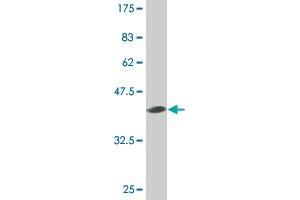 Western Blot detection against Immunogen (40. (SMO antibody  (AA 653-787))