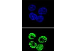 Confocal immunofluorescent analysis of CCNI2 Antibody (Center)(Cat#AP50818PU-N) with HepG2 cell followed by Alexa Fluor 488-conjugated goat anti-rabbit lgG (green).