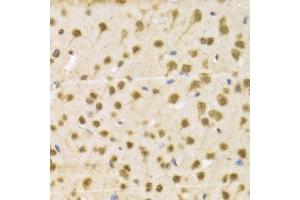 Immunohistochemistry (IHC) image for anti-RNA Binding Protein, Fox-1 Homolog 3 (RBFOX3) (AA 1-220) antibody (ABIN1513254)