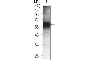 Western blot analysis using TEC mouse mAb against TEC (aa90-240)-hIgGFc transfected HEK293 cell lysate (1). (NR4A3 antibody)