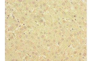 Immunohistochemistry of paraffin-embedded human liver tissue using ABIN7142304 at dilution of 1:100 (BDH2 antibody  (AA 1-245))