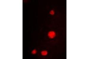 Immunofluorescent analysis of MCM3 staining in K562 cells. (MCM3 antibody)