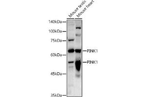 Western blot analysis of extracts of various cell lines, using PINK1 antibody (ABIN6128457, ABIN6145665, ABIN6145667 and ABIN6215214) at 1:1000 dilution. (PINK1 antibody  (AA 282-581))