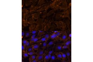 Immunofluorescence analysis of C6 cells using MMP3 Polyclonal Antibody (ABIN3021708, ABIN3021709, ABIN3021710 and ABIN6215578) at dilution of 1:100 (40x lens). (MMP3 antibody  (AA 248-477))