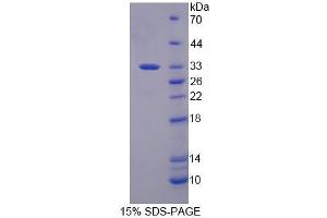 SDS-PAGE analysis of Mouse RFC2 Protein. (RFC2 Protein)
