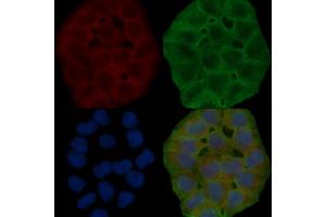 ABIN6264828 and ABIN6278632 staining Hela cells(30 min of UV treatment) by IF/ICC.
