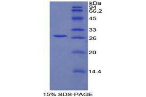 SDS-PAGE (SDS) image for Spondin 2 (SPON2) (AA 119-330) protein (His tag) (ABIN1878460)