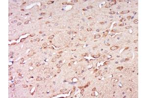 Paraformaldehyde-fixed, paraffin embedded rat brain, Antigen retrieval by boiling in sodium citrate buffer (pH6) for 15min, Block endogenous peroxidase by 3% hydrogen peroxide for 30 minutes, Blocking buffer (normal goat serum) at 37°C for 20min, Antibody incubation with Rabbit Anti-CCDC82 Polyclonal Antibody, Unconjugated  at 1:500 overnight at 4°C, followed by a conjugated secondary for 90 minutes and DAB staining. (CCDC82 antibody  (AA 301-400))