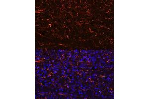 Immunofluorescence analysis of human spleen using CCR7 Rabbit mAb (ABIN7266309) at dilution of 1:100 (40x lens). (CCR7 antibody)