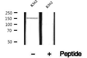 Western blot analysis of extracts of K562 cells, using Phospho-SHIP2 (Tyr986/987) Antibody. (INPPL1 antibody  (pTyr986, pTyr987))