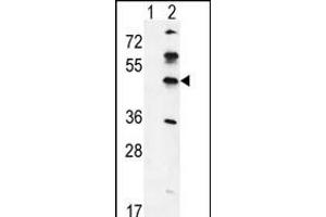 Western blot analysis of GK (arrow) using rabbit polyclonal GK Antibody (C-term) (ABIN651665 and ABIN2840349). (GKAP1 antibody  (C-Term))