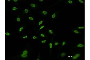 Immunofluorescence of monoclonal antibody to RERE on HeLa cell. (RERE antibody  (AA 85-193))