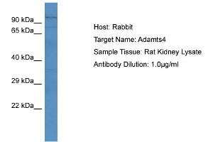 Host: RabbitTarget Name: Adamts4Antibody Dilution: 1. (ADAMTS4 antibody  (N-Term))