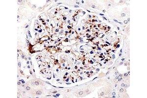 Immunohistochemical analysis of paraffin-embedded human kidney using FABP4 antibody at 1:25 dilution. (FABP4 antibody)