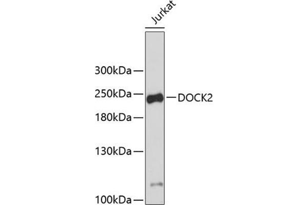 DOCK2 antibody  (AA 1551-1830)