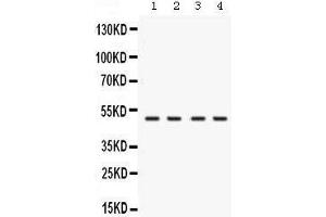 Western blot analysis of RNH1 expression in rat testis extract (lane 1), mouse brain extract (lane 2), human placenta extract (lane 2) and K562 whole cell lysates (lane 4). (RNH1 antibody  (N-Term))