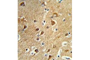 Formalin-fixed and paraffin-embedded human brain tissue reacted with PPM1H Antibody , which was peroxidase-conjugated to the secondary antibody, followed by DAB staining. (PPM1H antibody  (Middle Region))