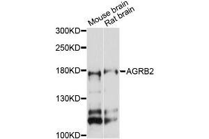 Western blot analysis of extracts of various cell lines, using AGRB2 antibody (ABIN6290298) at 1:3000 dilution.
