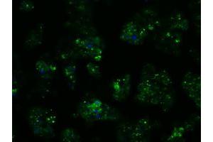Image no. 6 for anti-Proteasome (Prosome, Macropain) 26S Subunit, ATPase, 3 (PSMC3) antibody (ABIN1501331) (PSMC3 antibody)