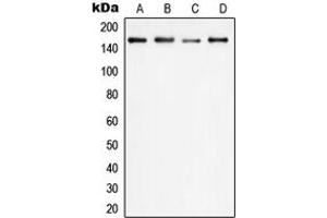Western blot analysis of PLC gamma 1 expression in HEK293T (A), HeLa (B), SP2/0 (C), PC12 (D) whole cell lysates. (Phospholipase C gamma 1 antibody  (Center))