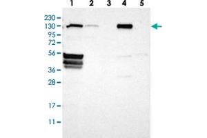 Western blot analysis of Lane 1: RT-4, Lane 2: U-251 MG, Lane 3: Human Plasma, Lane 4: Liver, Lane 5: Tonsil with FLII polyclonal antibody  at 1:250-1:500 dilution. (FLII antibody)