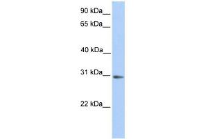 WB Suggested Anti-ABHD13 Antibody Titration:  0. (ABHD13 antibody  (N-Term))