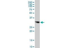 CBR1 MaxPab polyclonal antibody. (CBR1 antibody  (AA 1-277))