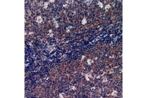 Immunohistochemical analysis of p47 phox staining in human tonsil formalin fixed paraffin embedded tissue section.