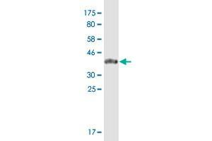 Western Blot detection against Immunogen (39. (ZNF585A antibody  (AA 1-113))