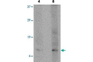 Western blot analysis of P53AIP1 in HL-60 cell lysate with P53AIP1 polyclonal antibody  at 4 and 8 ug/mL . (TP53AIP1 antibody  (N-Term))