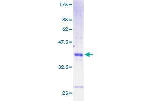 Cholecystokinin Protein (CCK) (AA 1-115) (GST tag)