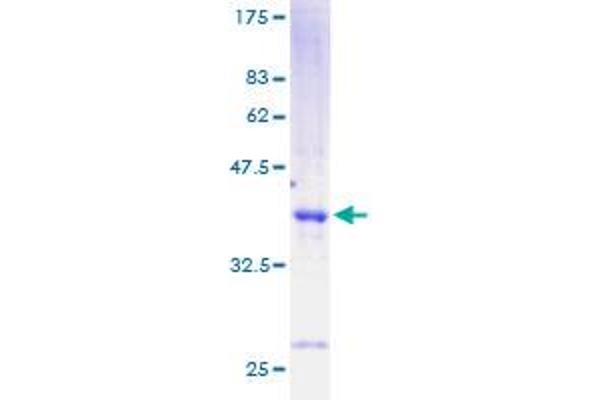 Cholecystokinin Protein (CCK) (AA 1-115) (GST tag)