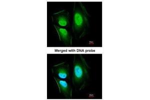 ICC/IF Image Immunofluorescence analysis of paraformaldehyde-fixed HeLa, using KIAA0494, antibody at 1:200 dilution. (KIAA0494 antibody  (Center))