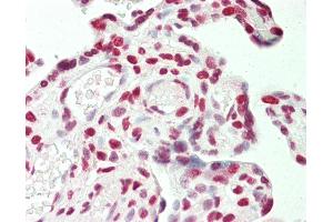 Anti-STAG1 / SA1 antibody IHC staining of human placenta. (Stromal Antigen 1 antibody  (AA 25-75))