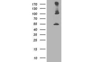 Western Blotting (WB) image for anti-Proteasome (Prosome, Macropain) 26S Subunit, Non-ATPase, 2 (PSMD2) antibody (ABIN1500481)