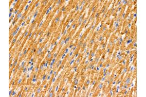 ABIN6262707 and ABIN6266568 at 1/100 staining Rat heart tissue by IHC-P.