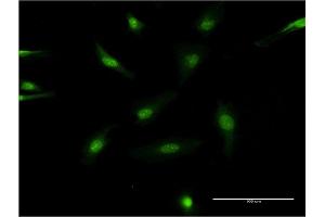 Immunofluorescence of monoclonal antibody to SRC on HeLa cell. (Src antibody  (AA 1-90))