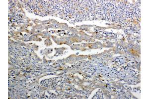 IHC analysis of GALNS using anti-GALNS antibody . (GALNS antibody  (AA 181-289))