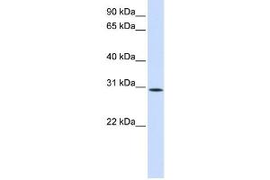 Western Blotting (WB) image for anti-Sushi Domain Containing 6 (SUSD6) antibody (ABIN2459068) (SUSD6/KIAA0247 antibody)