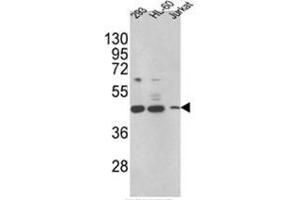 Western blot analysis of HSD17B7 Antibody (HSD17B7 antibody  (N-Term))