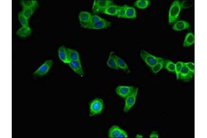 Immunofluorescent analysis of HepG2 cells using ABIN7166166 at dilution of 1:100 and Alexa Fluor 488-congugated AffiniPure Goat Anti-Rabbit IgG(H+L) (SBNO2 antibody  (AA 6-146))