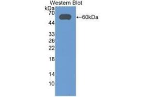 Detection of Recombinant ALDH7A1, Human using Monoclonal Antibody to Aldehyde Dehydrogenase 7 Family, Member A1 (ALDH7A1) (ALDH7A1 antibody  (AA 1-539))